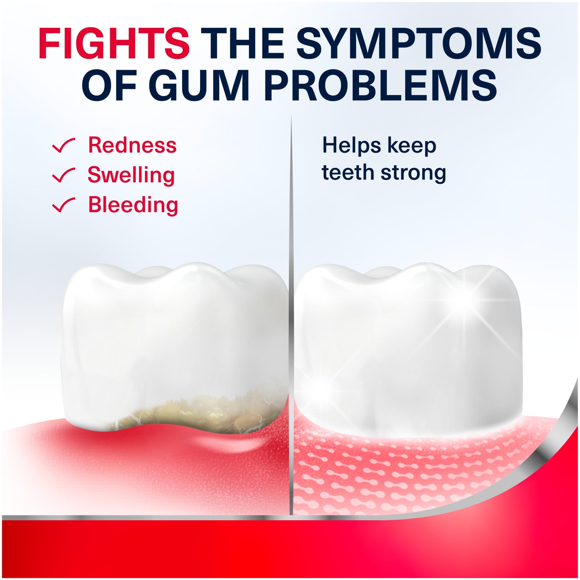 Parodontax Complete Protection Gingivitis Toothpaste, Pure Fresh Mint, 3.4 Oz